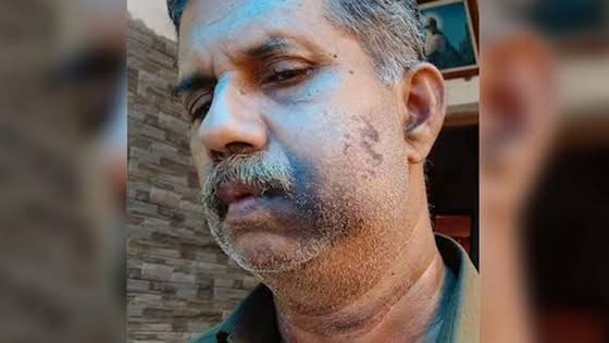 ৪র্থ শ্রেণিতে পড়ার সময় মেরেছিল সহপাঠী, ৫০ বছর পর প্রতিশোধ!