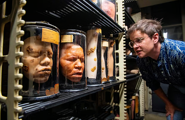 জাদুঘরে কীভাবে দেখানো হবে আইনস্টাইনের মস্তিষ্ক? মিউটার জাদুঘরের জ্যেষ্ঠ পরিচালক সারা রে কুষ্ঠরোগে আক্রান্ত রোগীদের মুখের মোমের তৈরি মডেল পরীক্ষা করছেন। ছবি: এএফপি