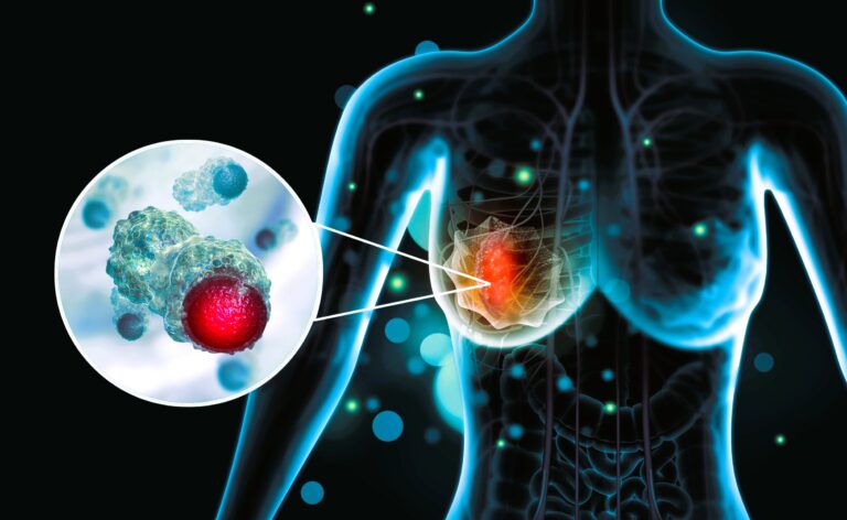 স্তন-ত্বক ক্যানসারের নতুন ইমিউনোথেরাপি ওষুধ আবিষ্কার