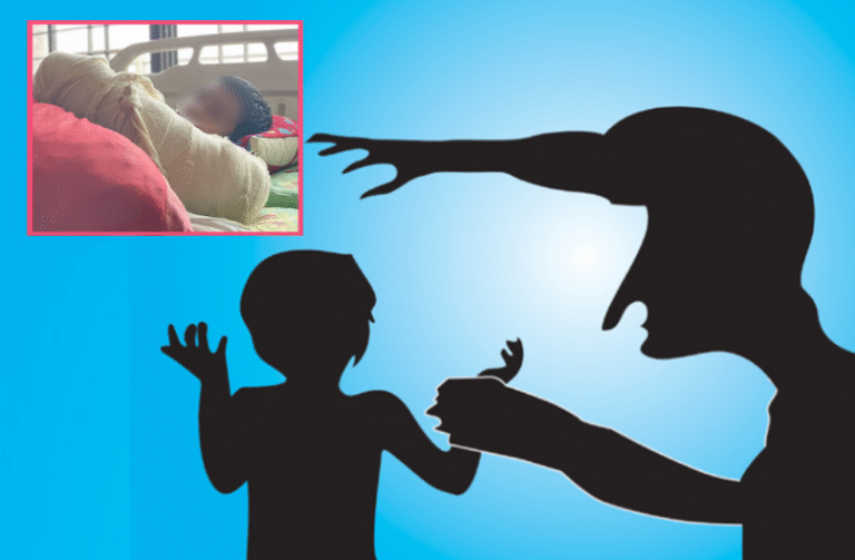 মাদ্রাসা শিক্ষকের পিটুনিতে ভাঙল শিক্ষার্থীর হাত