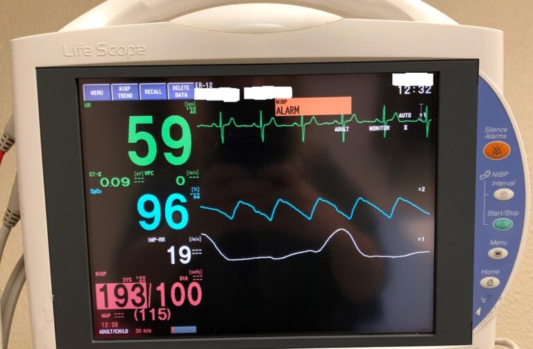 সিসিইউ, আইসিইউ ও ভেন্টিলেশনে কখন কোন রোগী নেওয়া হয়?